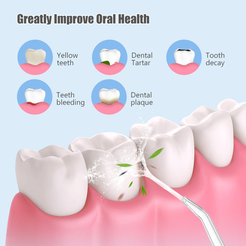 Hilo Dental Inalámbrico Con Agua Para Limpiador De Dientes