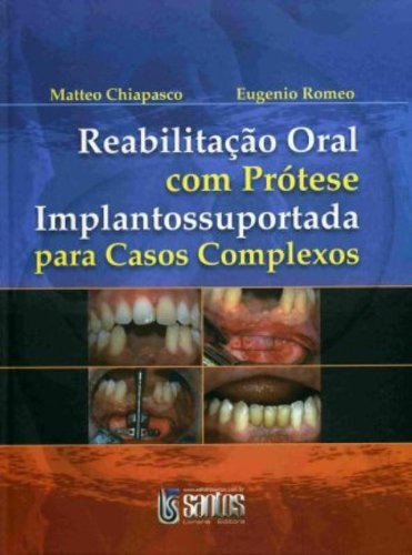 Reabilitação Oral Com Prótese Implantossuportada, De M. Editora Santos, Capa Dura Em Português