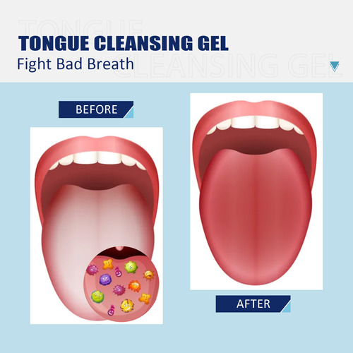 Gel Limpiador De Lengua De 2 Piezas, Kit De Cepillo De Limpi