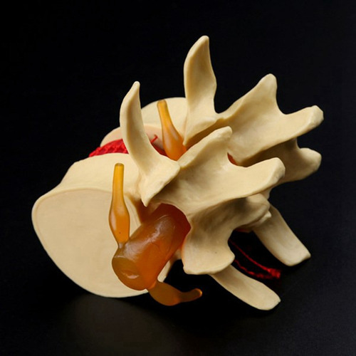 Modelo De Vértebras Lumbares: Columna Anatómica Hernia D