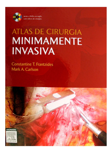 Atlas De Cirurgia Minimamente Invasiva