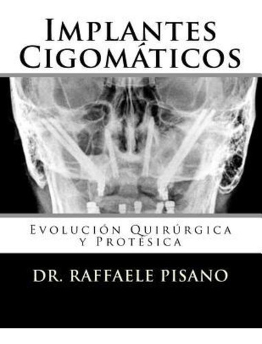 Libro : Implantes Cigomaticos: Evolucion Quirurgica Y Pro...