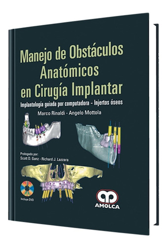 Manejo De Obstáculos  Anatómicos En Cirugía Implantar.