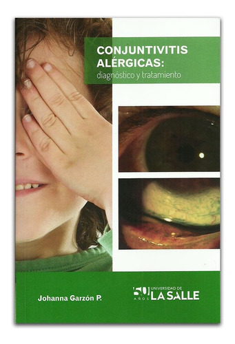Libro: Conjuntivitis Alérgicas: Diagnóstico Y Tratamiento (s