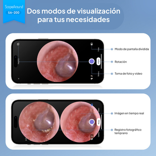 Video Otoscopio Monitor Y Cámara Todo En Uno, Android, Ios