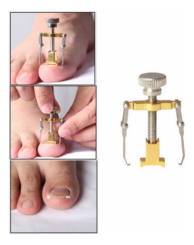 Corrector Profesional De Uñas Encarnadas De Acero Inoxidable