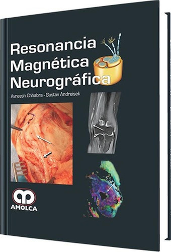 Resonancia Magnética Neurográfica. Libro Médico.