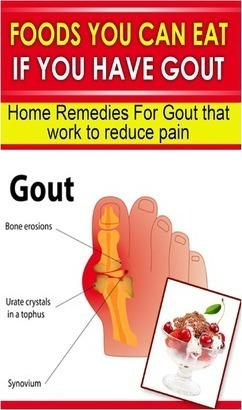 Foods You Can Eat If You Have Gout - Doc Goodman (paperba...