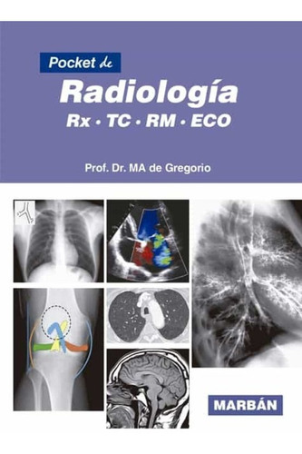 Pocket De Radiología Rx  Tc  Rm  Eco  De Gregorio