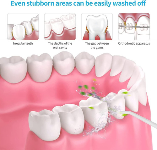 Irrigador Bucal Con 5 Puntas