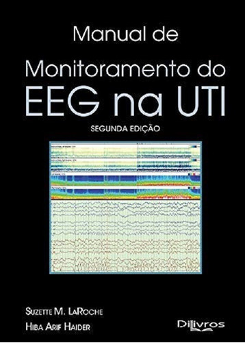 Manual De Monitoramento Do Eeg Na Uti