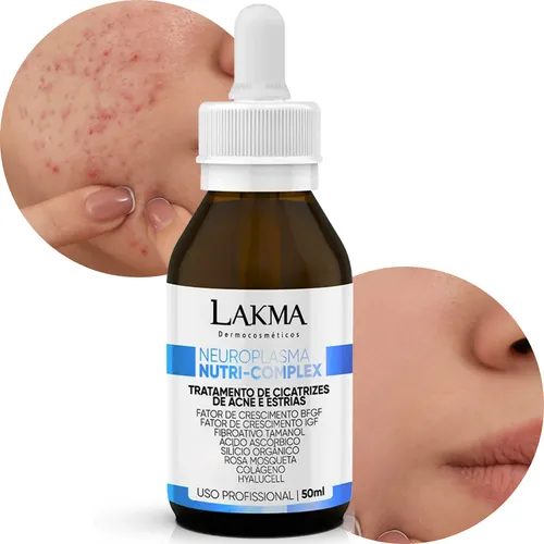 Lakma Neuroplasma Nutri Complex 50ml Cicatriz Acne estrias Tipo d...