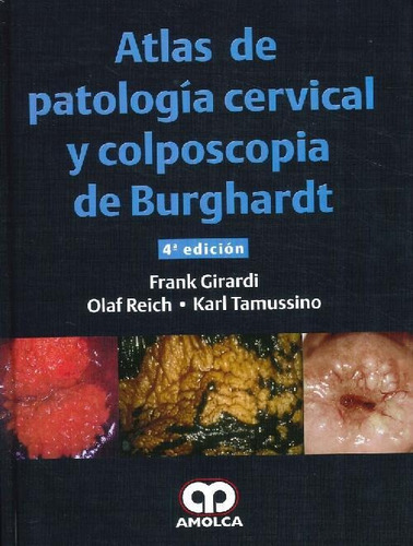 Libro Atlas De Patología Cervical Y Colposcopia De Burghardt