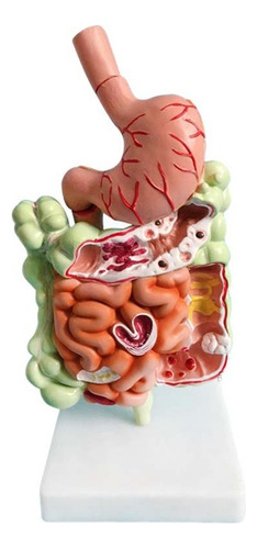 Modelo Del Sistema Digestivo Humano: Anatomía Del Estómago,