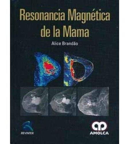 Resonancia Magnética De La Mama