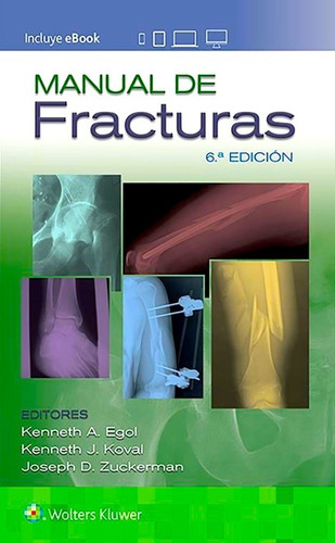 Egol Manual De Fracturas  Nuevo Y Original 