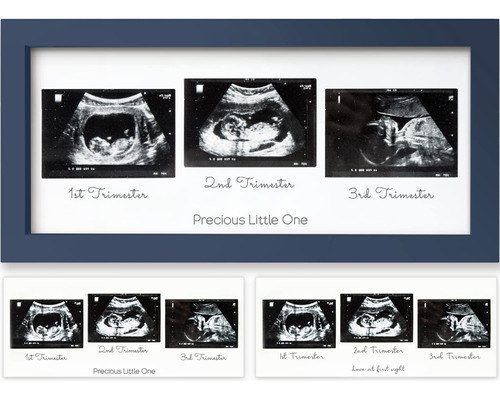 Sonogram - Marco De Fotos Con Ultrasonido De Tro Para Regalo