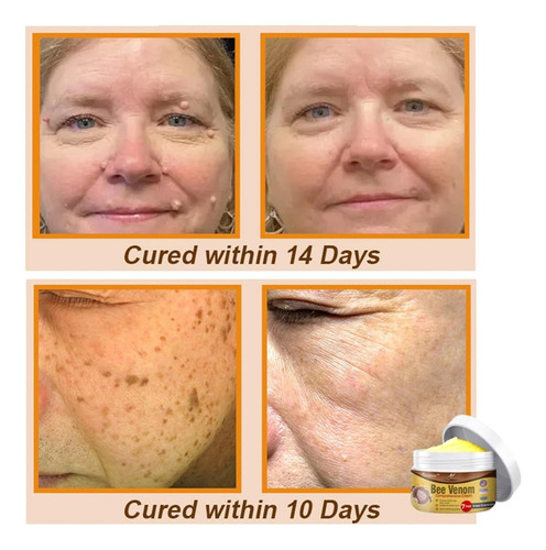 Bee Comprehensive Cream, Crema De Tratamiento Para Todo Tipo