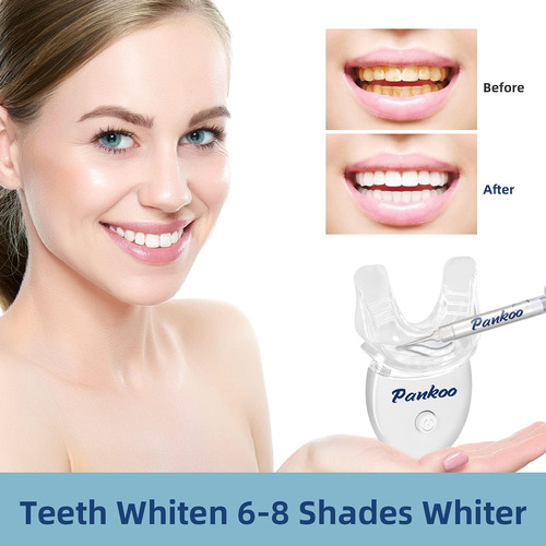 Kit De Blanqueamiento De Dientes Con Luz Led Para Dientes Se