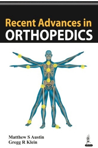Libro Recent Advances In Orthopedics De Matthews S. Austin,