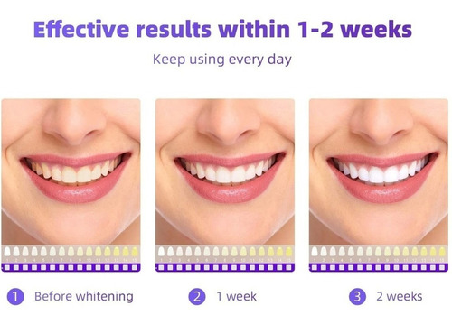 Kit De Blanqueamiento Dental. Férula Luz Led Peróxido