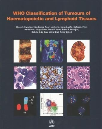 Who Classification Of Tumours Of Haematopoietic And Lymph...