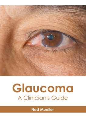 Libro Glaucoma: A Clinician's Guide - Mueller, Ned