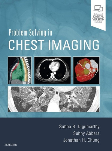 Libro Problem Solving In Chest Imaging - Digumarthy/abbara/c