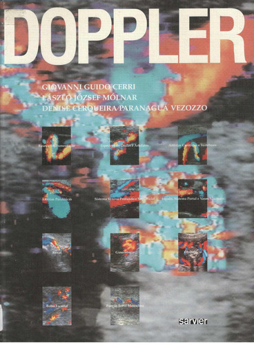 Doppler, de Cerri. Sarvier Editora de Livros Médicos Ltda, capa mole em português, 1996