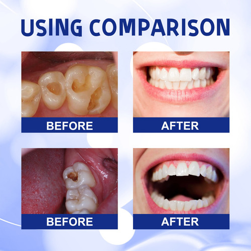 Pasta De Dientes Para Reducir La Caries Para La Limpieza Buc