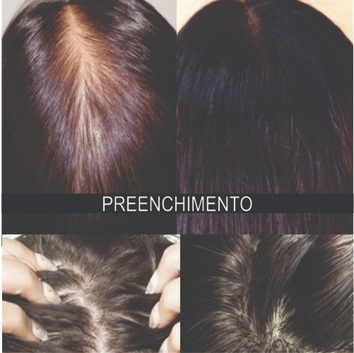 Antiqueda Capilar Barba Cabelo Kabelol Oleo Essencial