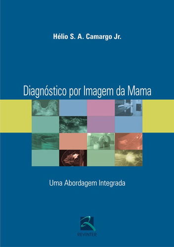 Diagnóstico por Imagem da Mama: Uma Abordagem Integrada, de Camargo Junior, Hélio S. A.. Editora Thieme Revinter Publicações Ltda, capa dura em português, 2008