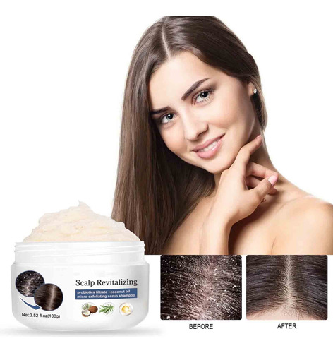 Shampoo De Enxofre Para Controlar A Limpeza De Óleo E Folícu
