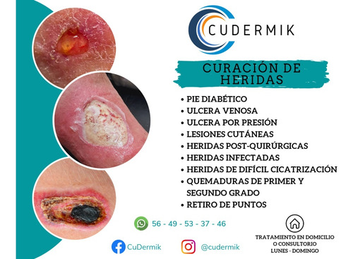 Curacion De Heridas Avanzadas.