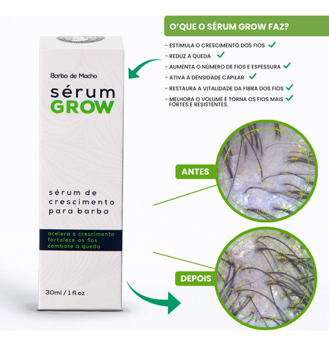 Kit Fortificante Shampoo Sh Force+ E Sérum Grow Cabelo Barba