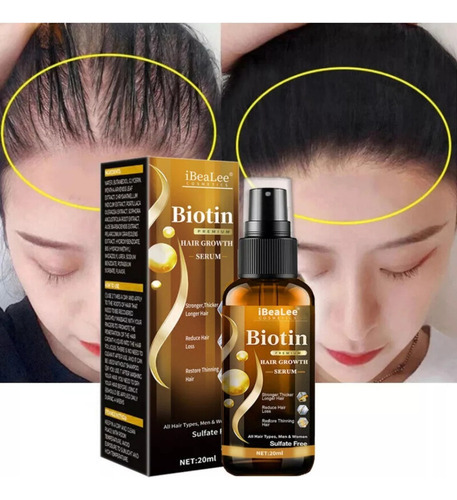 - Óleos De Crescimento Em Spray Para Cabelo Anti-queda De