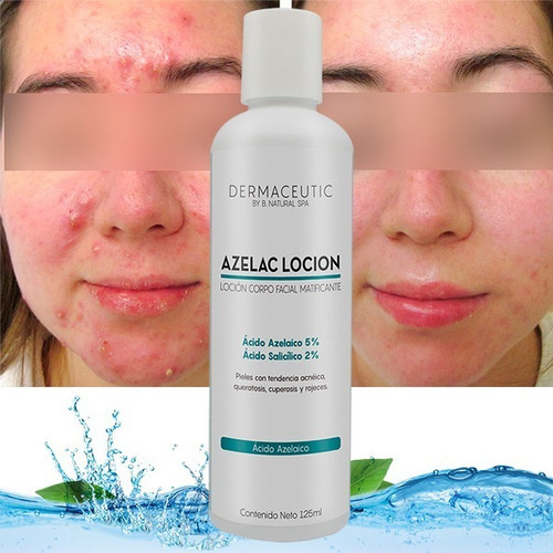 Imagen 2 de 5 de Azelac Loción 125ml Tipo De Piel Piel Grasa/acnéica
