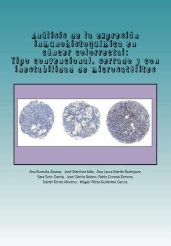 Libro: Análisis De La Expresión Inmunohistoquímica En Cáncer
