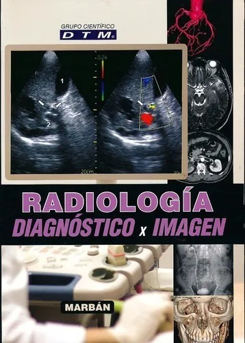 Dtm Radiología Diagnostico Por Imagen Flexilibro, De Grupo Científico Dtm., Vol. 1. Editorial Marbán, Tapa Blanda, Edición 2016 - Color En Español, 2016