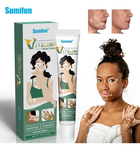 Crema Hidratante S Skin Care Crema Para Vitíligo Remove Wh 8
