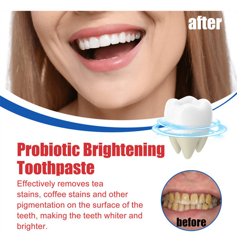 Pasta De Dientes Blanqueadora Con Probióticos Sp-6 120 G*2