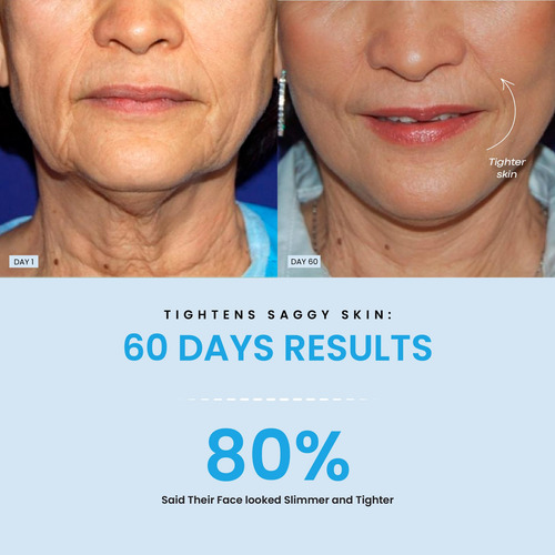 Masajeador Facial Y De Cuello Con Luz Led Liftlab Skin Sculp