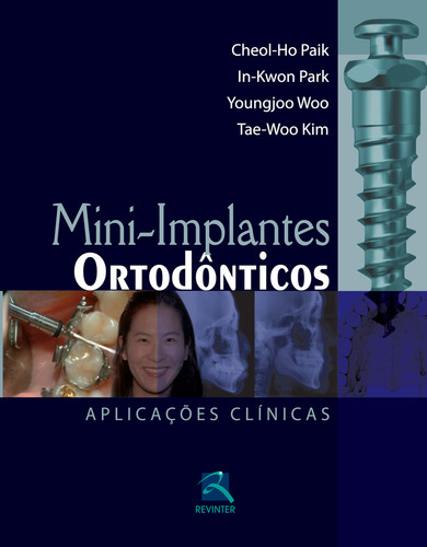 Mini-Implantes Ortodônticos: aplicações clínicas, de Paik, Cheol-Ho. Editorial Thieme Revinter, capa dura em português, 2011