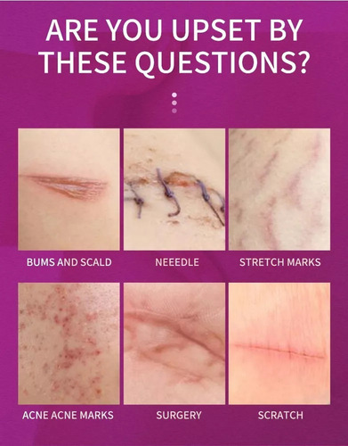 Crema Para Cicatrices, Crema Para Cicatrices Quirúrgicas,