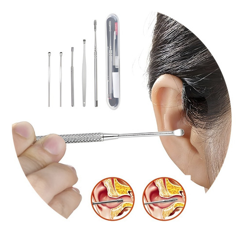 Imagen 7 de 10 de Herramientas Para Limpieza De Oídos Kit Quitar Cera Del Oído