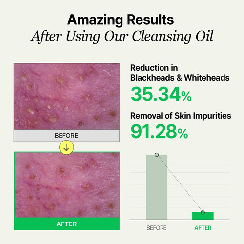 Aceite De Limpieza Profunda Lha Maquillaje Removedor De Punt