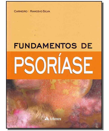 Fundamentos De Psoriase -  01ed/17
