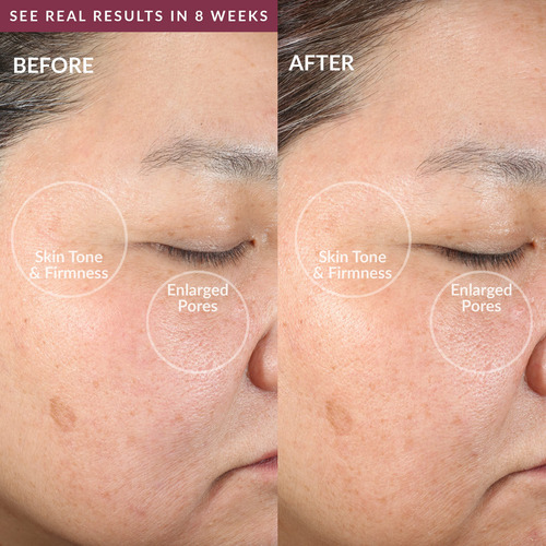 Pmd Clean Dispositivo De Limpieza Facial Inteligente Con