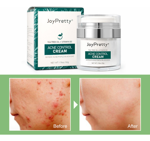 Pomada E Creme De Remoção Q Mark And Removal Cream Mil 9003