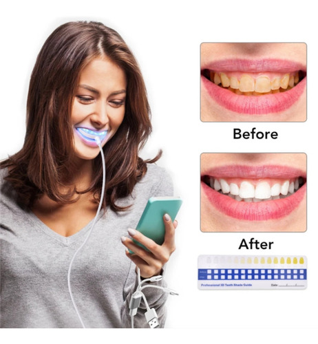Imagen 3 de 3 de Blanqueamiento Dental Lampara Usb + 3 Tubos Al 44%